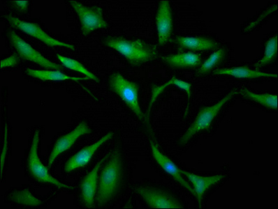 SBDS Antibody - Immunofluorescence staining of Hela cells at a dilution of 1:133, counter-stained with DAPI. The cells were fixed in 4% formaldehyde, permeabilized using 0.2% Triton X-100 and blocked in 10% normal Goat Serum. The cells were then incubated with the antibody overnight at 4 °C.The secondary antibody was Alexa Fluor 488-congugated AffiniPure Goat Anti-Rabbit IgG (H+L) .