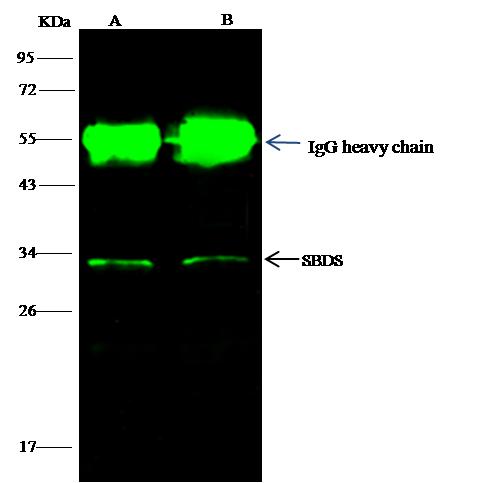 SBDS Antibody - SBDS was immunoprecipitated using: Lane A: 0.5 mg HepG2 Whole Cell Lysate. Lane B: 0.5 mg Jurkat Whole Cell Lysate. 1 uL anti-SBDS rabbit polyclonal antibody and 60 ug of Immunomagnetic beads Protein G. Primary antibody: Anti-SBDS rabbit polyclonal antibody, at 1:500 dilution. Secondary antibody: Dylight 800-labeled antibody to rabbit IgG (H+L), at 1:5000 dilution. Developed using the odssey technique. Performed under reducing conditions. Predicted band size: 29 kDa. Observed band size: 29 kDa.