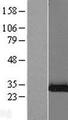 SBDS Protein - Western validation with an anti-DDK antibody * L: Control HEK293 lysate R: Over-expression lysate