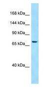 SBF1 / MTMR5 Antibody - SBF1 / MTMR5 antibody Western Blot of 293T.  This image was taken for the unconjugated form of this product. Other forms have not been tested.
