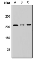 SBF1 / MTMR5 Antibody