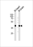 SBK1 Antibody - Western blot of lysates from mouse heart, mouse brain tissue lysate (from left to right) with Sbk1 Antibody. Antibody was diluted at 1:1000 at each lane. A goat anti-rabbit IgG H&L (HRP) at 1:10000 dilution was used as the secondary antibody. Lysates at 20 ug per lane.