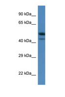 SBK1 Antibody - SBK1 antibody Western blot of Mouse Thymus lysate. Antibody concentration 1 ug/ml. This image was taken for the unconjugated form of this product. Other forms have not been tested.