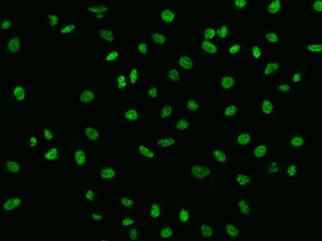 SBNO1 Antibody - Immunofluorescence staining of SBNO1 in A549 cells. Cells were fixed with 4% PFA, permeabilzed with 0.3% Triton X-100 in PBS, blocked with 10% serum, and incubated with rabbit anti-Human SBNO1 polyclonal antibody (dilution ratio 1:200) at 4°C overnight. Then cells were stained with the Alexa Fluor 488-conjugated Goat Anti-rabbit IgG secondary antibody (green). Positive staining was localized to Nucleus.