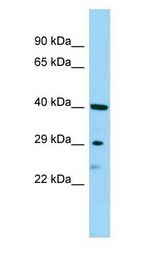 SBSN Antibody - SBSN antibody Western Blot of Jurkat.  This image was taken for the unconjugated form of this product. Other forms have not been tested.