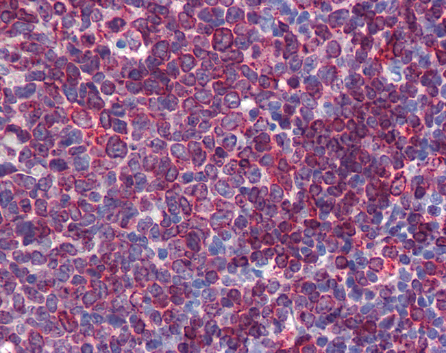 SC5D / ERG3 Antibody - Anti-SC5DL antibody IHC of human tonsil. Immunohistochemistry of formalin-fixed, paraffin-embedded tissue after heat-induced antigen retrieval. Antibody concentration 5 ug/ml.  This image was taken for the unconjugated form of this product. Other forms have not been tested.