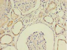 SCA2 / LY6E Antibody - Immunohistochemistry of paraffin-embedded human kidney tissue using antibody at 1:100 dilution.  This image was taken for the unconjugated form of this product. Other forms have not been tested.