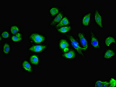 SCA2 / LY6E Antibody - Immunofluorescent analysis of A549 cells using LY6E Antibody at dilution of 1:100 and Alexa Fluor 488-congugated AffiniPure Goat Anti-Rabbit IgG(H+L)