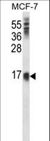 SCA2 / LY6E Antibody - LY6E Antibody western blot of MCF-7 cell line lysates (35 ug/lane). The LY6E antibody detected the LY6E protein (arrow).