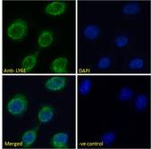 SCA2 / LY6E Antibody - SCA2 / LY6E antibody immunofluorescence analysis of paraformaldehyde fixed L929 cells (Mouse fibroblast cell line), permeabilized with 0.15% Triton. Primary incubation 1hr (10ug/ml) followed by Alexa Fluor 488 secondary antibody (2ug/ml), showing vesicle staining. The nuclear stain is DAPI (blue).