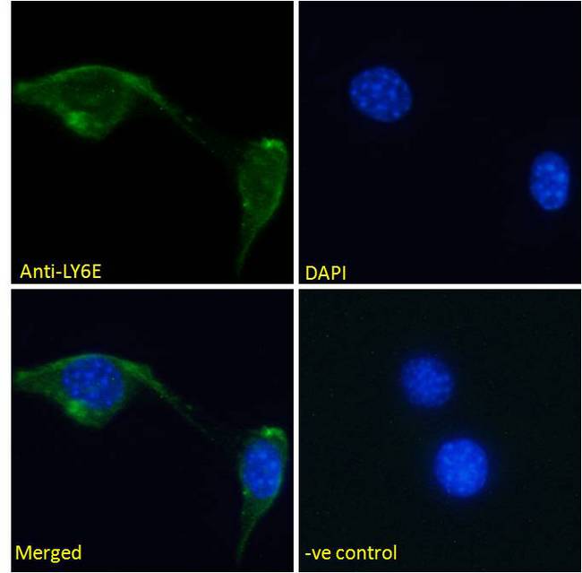 SCA2 / LY6E Antibody - SCA2 / LY6E antibody immunofluorescence analysis of paraformaldehyde fixed NIH3T3 cells, permeabilized with 0.15% Triton. Primary incubation 1hr (10ug/ml) followed by Alexa Fluor 488 secondary antibody (2ug/ml), showing membrane staining. The nuclear stain is DAPI (blue). Negative control: Unimmunized goat IgG (10ug/ml) followed by Alexa Fluor 488 secondary antibody (2ug/ml).