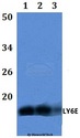 SCA2 / LY6E Antibody - Western blot of LY6E antibody at 1:500 dilution. Lane 1: HEK293T whole cell lysate. Lane 2: Raw264.7 whole cell lysate. Lane 3: H9C2 whole cell lysate.