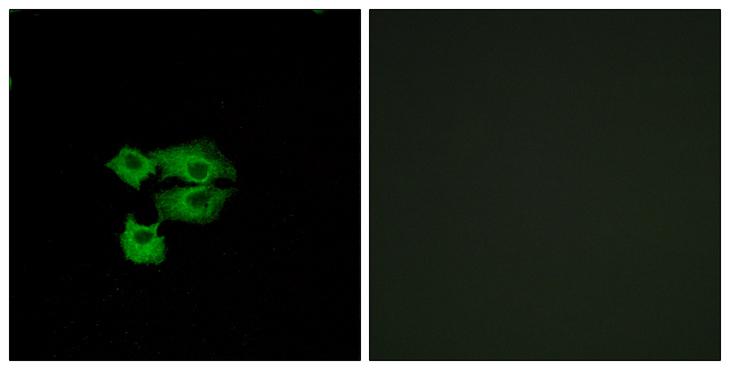 SCA2 / LY6E Antibody - Peptide - + Immunofluorescence analysis of A549 cells, using LY6E antibody.