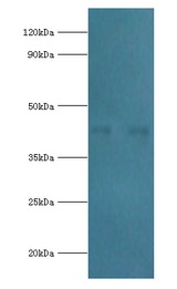 SCAD / ACADS Antibody - Western blot. All lanes: Short-chain specific acyl-CoA dehydrogenase, mitochondrial antibody at 7 ug/ml. Lane 1: 293T whole cell lysate. Lane 2: HepG2 whole cell lysate. secondary Goat polyclonal to rabbit at 1:10000 dilution. Predicted band size: 44 kDa. Observed band size: 44 kDa.