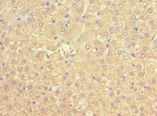 SCAD / ACADS Antibody - Immunohistochemistry of paraffin-embedded human liver using antibody at 1:100 dilution.