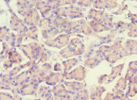 SCAD / ACADS Antibody - Immunohistochemistry of paraffin-embedded human pancreas using antibody at 1:100 dilution.