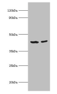 SCAD / ACADS Antibody - Western blot All lanes: Short-chain specific acyl-CoA dehydrogenase, mitochondrial antibody at 7µg/ml Lane 1: 293T whole cell lysate Lane 2: HepG2 whole cell lysate Secondary Goat polyclonal to rabbit IgG at 1/10000 dilution Predicted band size: 44 kDa Observed band size: 44 kDa