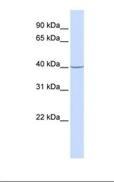 SCAD / ACADS Antibody - 721_B cell lysate. Antibody concentration: 1.0 ug/ml. Gel concentration: 12%.  This image was taken for the unconjugated form of this product. Other forms have not been tested.