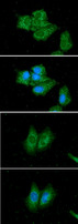 SCAD / ACADS Antibody - ICC/IF analysis of ACADS in Hep3B cells line, stained with DAPI (Blue) for nucleus staining and monoclonal anti-human ACADS antibody (1:100) with goat anti-mouse IgG-Alexa fluor 488 conjugate (Green).ICC/IF analysis of ACADS in A549 cells line, stained with DAPI (Blue) for nucleus staining and monoclonal anti-human ACADS antibody (1:100) with goat anti-mouse IgG-Alexa fluor 488 conjugate (Green).