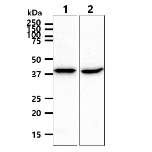 SCAD / ACADS Antibody - The cell lysate (40ug) were resolved by SDS-PAGE, transferred to PVDF membrane and probed with anti-human ACADS antibody (1:1000). Proteins were visualized using a goat anti-mouse secondary antibody conjugated to HRP and an ECL detection system. Lane 1 : HepG2 cell lysate Lane 2 : LnCap cell lysate