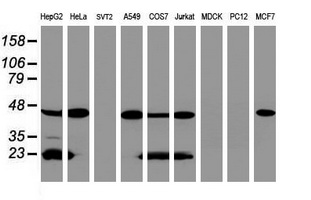 SCAD / ACADS Antibody - Western blot of extracts (35 ug) from 9 different cell lines by using anti-ACADS monoclonal antibody (HepG2: human; HeLa: human; SVT2: mouse; A549: human; COS7: monkey; Jurkat: human; MDCK: canine; PC12: rat; MCF7: human).