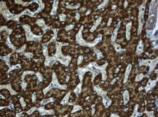 SCAD / ACADS Antibody - IHC of paraffin-embedded Human liver tissue using anti-ACADS mouse monoclonal antibody.