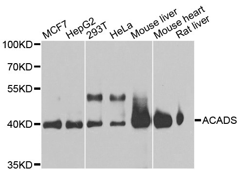 SCAD / ACADS Antibody - Western blot analysis of extracts of various cell lines, using ACADS antibody at 1:1000 dilution. The secondary antibody used was an HRP Goat Anti-Rabbit IgG (H+L) at 1:10000 dilution. Lysates were loaded 25ug per lane and 3% nonfat dry milk in TBST was used for blocking. An ECL Kit was used for detection and the exposure time was 15s.