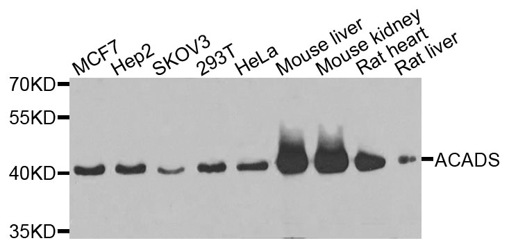 SCAD / ACADS Antibody - Western blot analysis of extracts of various cells.