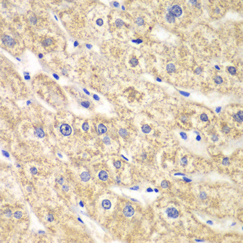 SCAD / ACADS Antibody - Immunohistochemistry of paraffin-embedded human liver injury tissue.