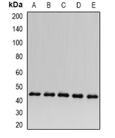 SCAD / ACADS Antibody - Western blot analysis of ACADS expression in HepG2 (A); HeLa (B); mouse kidney (C); rat heart (D); rat liver (E) whole cell lysates.