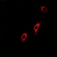 SCAD / ACADS Antibody - Immunofluorescent analysis of ACADS staining in U2OS cells. Formalin-fixed cells were permeabilized with 0.1% Triton X-100 in TBS for 5-10 minutes and blocked with 3% BSA-PBS for 30 minutes at room temperature. Cells were probed with the primary antibody in 3% BSA-PBS and incubated overnight at 4 deg C in a humidified chamber. Cells were washed with PBST and incubated with a DyLight 594-conjugated secondary antibody (red) in PBS at room temperature in the dark.