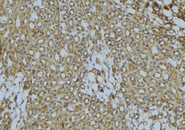 SCAD / ACADS Antibody - 1:100 staining mouse kidney tissue by IHC-P. The sample was formaldehyde fixed and a heat mediated antigen retrieval step in citrate buffer was performed. The sample was then blocked and incubated with the antibody for 1.5 hours at 22°C. An HRP conjugated goat anti-rabbit antibody was used as the secondary.