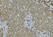 SCAD / ACADS Antibody - 1:100 staining mouse kidney tissue by IHC-P. The sample was formaldehyde fixed and a heat mediated antigen retrieval step in citrate buffer was performed. The sample was then blocked and incubated with the antibody for 1.5 hours at 22°C. An HRP conjugated goat anti-rabbit antibody was used as the secondary.