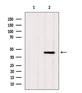 SCAD / ACADS Antibody - Western blot analysis of extracts of rat heart tissue using ACADS antibody. Lane 1 was treated with the blocking peptide.