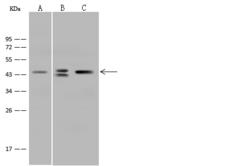 SCAD / ACADS Antibody - Anti-ACADS rabbit polyclonal antibody at 1:500 dilution. Lane A: HepG2 Whole Cell Lysate. Lane B: 293T Whole Cell Lysate. Lane C: MOLT4 Whole Cell Lysate. Lysates/proteins at 30 ug per lane. Secondary: Goat Anti-Rabbit IgG (H+L)/HRP at 1/10000 dilution. Developed using the ECL technique. Performed under reducing conditions. Predicted band size: 44 kDa. Observed band size: 44 kDa.