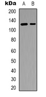 SCAF4 Antibody - Western blot analysis of SFRS15 expression in RT4 (A); Colo205 (B) whole cell lysates.