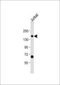 SCAF4 Antibody - Anti-SFRS15 Antibody at 1:1000 dilution + Jurkat whole cell lysate Lysates/proteins at 20 ug per lane. Secondary Goat Anti-Rabbit IgG, (H+L), Peroxidase conjugated at 1:10000 dilution. Predicted band size: 126 kDa. Blocking/Dilution buffer: 5% NFDM/TBST.