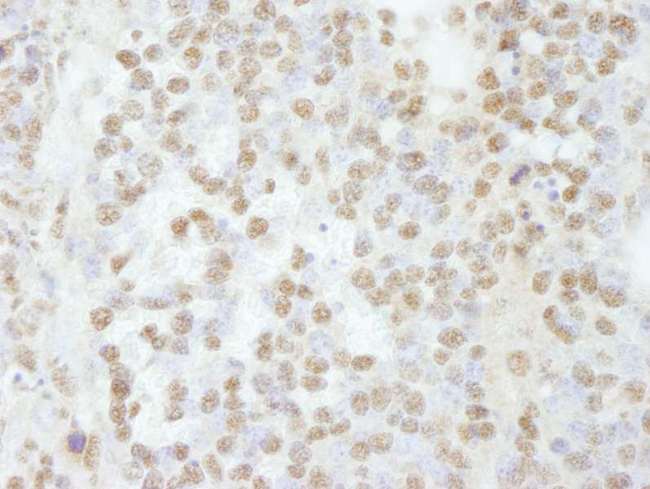 SCAF8 Antibody - Detection of Mouse RBM16 by Immunohistochemistry. Sample: FFPE section of mouse teratoma. Antibody: Affinity purified rabbit anti-RBM16 used at a dilution of 1:250.