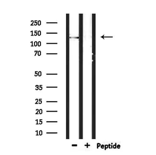 SCAF8 Antibody - Western blot analysis of extracts of mouse muscle using RBM16 antibody.
