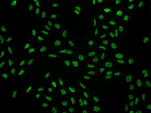 SCAF8 Antibody - Immunofluorescence staining of RBM16 in U2OS cells. Cells were fixed with 4% PFA, permeabilzed with 0.3% Triton X-100 in PBS, blocked with 10% serum, and incubated with rabbit anti-Human RBM16 polyclonal antibody (dilution ratio 1:200) at 4°C overnight. Then cells were stained with the Alexa Fluor 488-conjugated Goat Anti-rabbit IgG secondary antibody (green). Positive staining was localized to Nucleus.