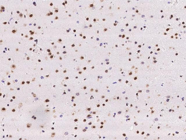 SCAF8 Antibody - Immunochemical staining of human RBM16 in human brain with rabbit polyclonal antibody at 1:100 dilution, formalin-fixed paraffin embedded sections.