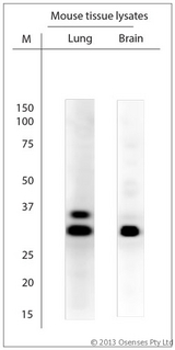SCAMP1 / SCAMP Antibody - Rabbit antibody to SCAMP1 (2-50). WB on mouse tissue lysates. Blocking with 0.5% LFDM for 30 min at RT; Primary antibody used at 1:5000 dilution incubated overnight at 4C.