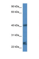 SCAMP1 / SCAMP Antibody - SCAMP1 antibody Western blot of Mouse Spleen lysate. Antibody concentration 1 ug/ml.  This image was taken for the unconjugated form of this product. Other forms have not been tested.