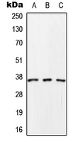 SCAMP1 / SCAMP Antibody - Western blot analysis of SCAMP1 expression in HeLa (A); Raw264.7 (B); rat brain (C) whole cell lysates.