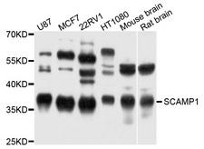 SCAMP1 / SCAMP Antibody - Western blot analysis of extract of various cells.
