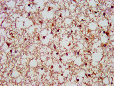 SCAMP1 / SCAMP Antibody - Immunohistochemistry image at a dilution of 1:500 and staining in paraffin-embedded human brain tissue performed on a Leica BondTM system.