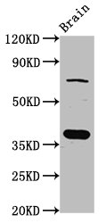 SCAMP1 / SCAMP Antibody - Positive Western Blot detected in Rat brain tissue. All lanes: SCAMP1 antibody at 4 µg/ml Secondary Goat polyclonal to rabbit IgG at 1/50000 dilution. Predicted band size: 38, 19 KDa. Observed band size: 38 KDa