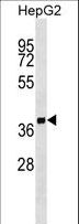 SCAMP2 Antibody - SCAMP2 Antibody western blot of HepG2 cell line lysates (35 ug/lane). The SCAMP2 antibody detected the SCAMP2 protein (arrow).