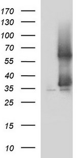 SCAMP2 Antibody - HEK293T cells were transfected with the pCMV6-ENTRY control (Left lane) or pCMV6-ENTRY SCAMP2 (Right lane) cDNA for 48 hrs and lysed. Equivalent amounts of cell lysates (5 ug per lane) were separated by SDS-PAGE and immunoblotted with anti-SCAMP2.
