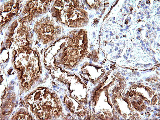 SCAMP2 Antibody - IHC of paraffin-embedded Human Kidney tissue using anti-SCAMP2 mouse monoclonal antibody. (Heat-induced epitope retrieval by 10mM citric buffer, pH6.0, 120°C for 3min).